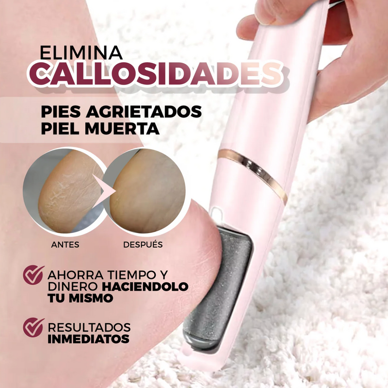 Kit Soléa Pro® - Elimina Piel Seca y Callos Duros en 5 Minutos